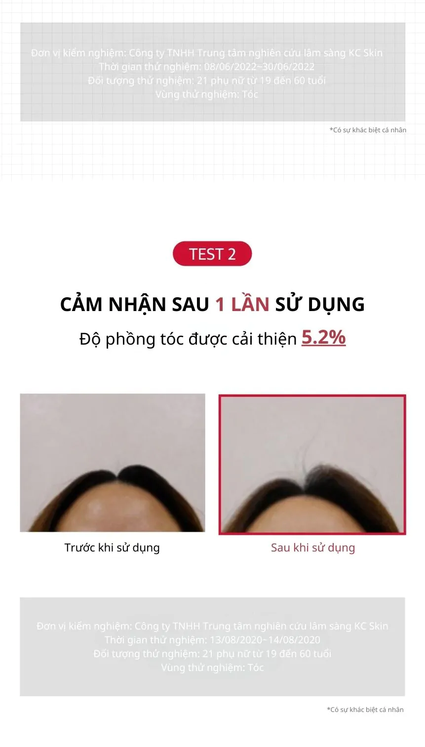 Dầu Gội Ngăn Ngừa Rụng Tóc KUNDAL Caffeine 500ml