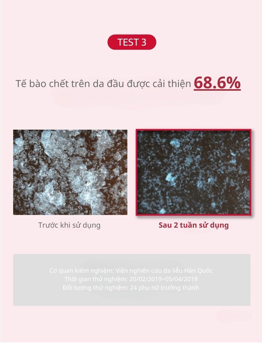 Dầu Gội Ngăn Ngừa Rụng Tóc KUNDAL Caffeine 500ml