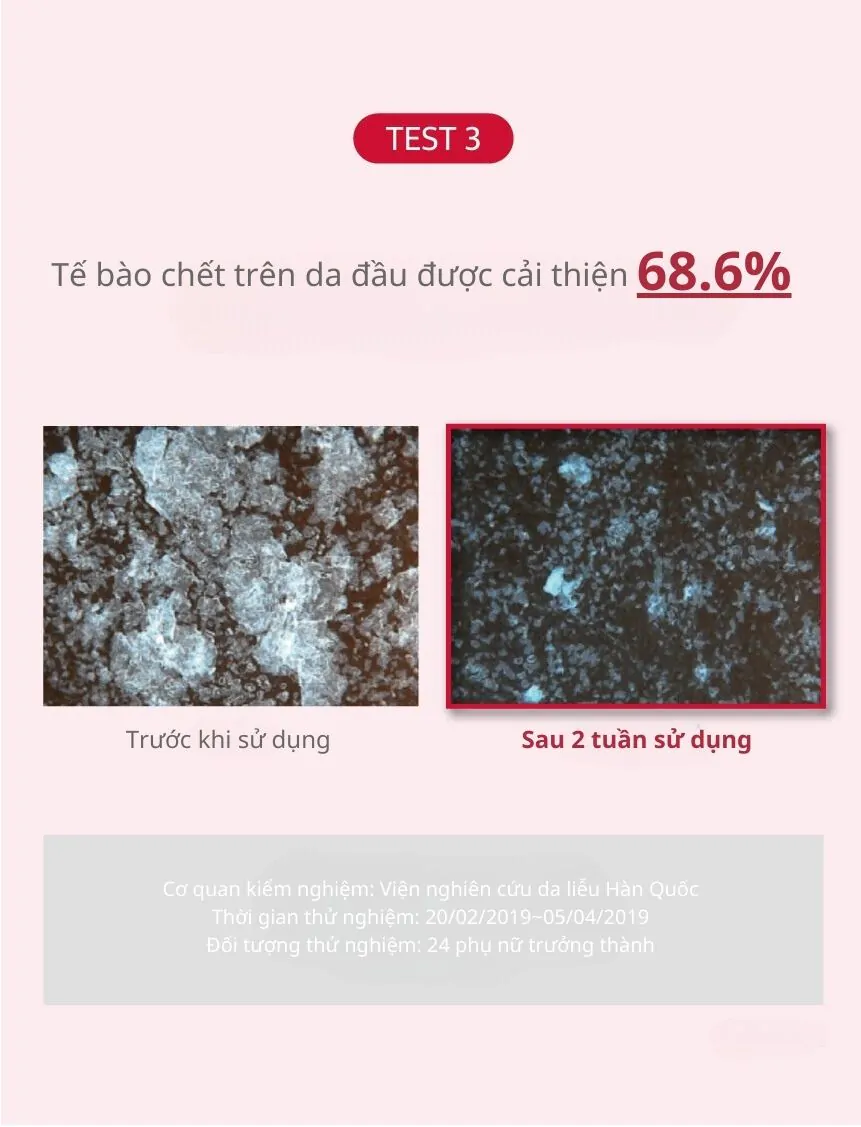 Dầu Gội Ngăn Ngừa Rụng Tóc KUNDAL Caffeine 500ml