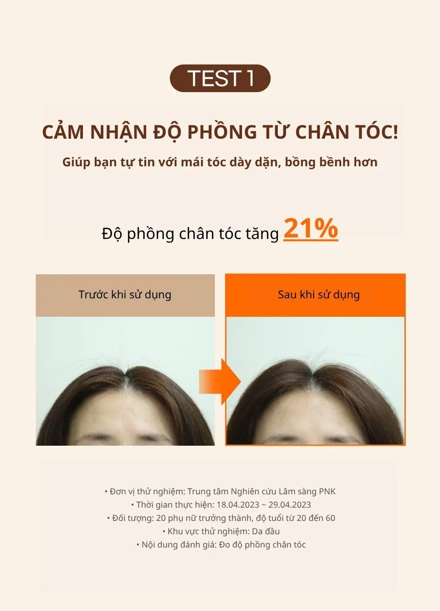 Dầu Xả Ngăn Ngừa Rụng Tóc KUNDAL REAL BEER YEAST 200ml