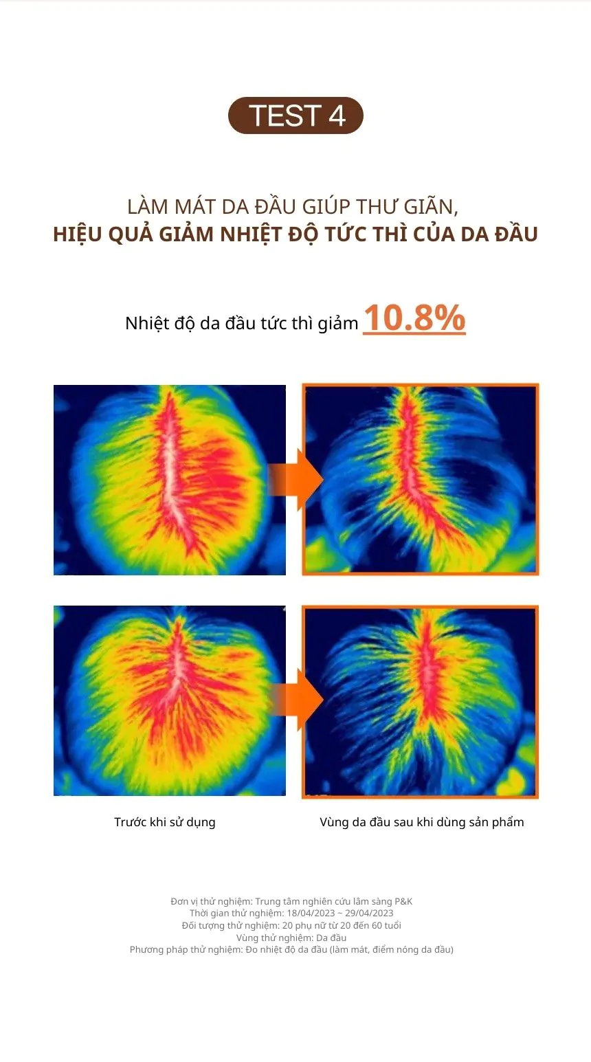 Dầu Xả Ngăn Ngừa Rụng Tóc KUNDAL REAL BEER YEAST 200ml