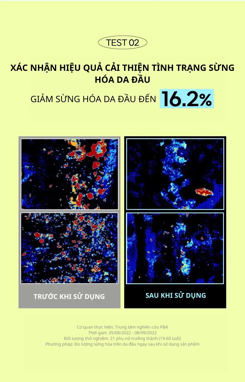 Dầu gội ngăn ngừa mùi da đầu Kundal 400ml