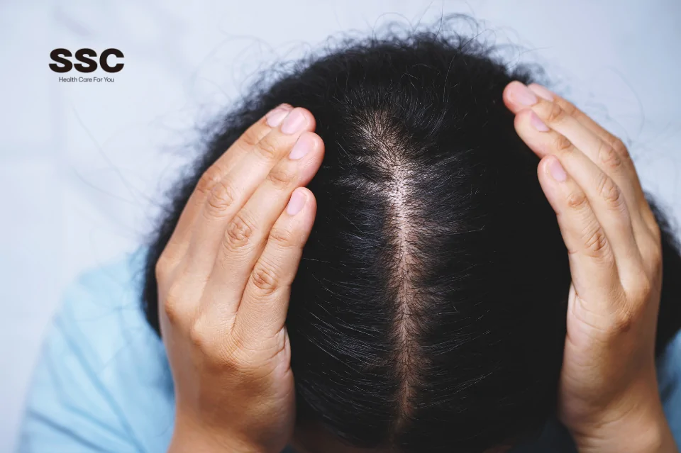 Lão hóa da đầu là gì?