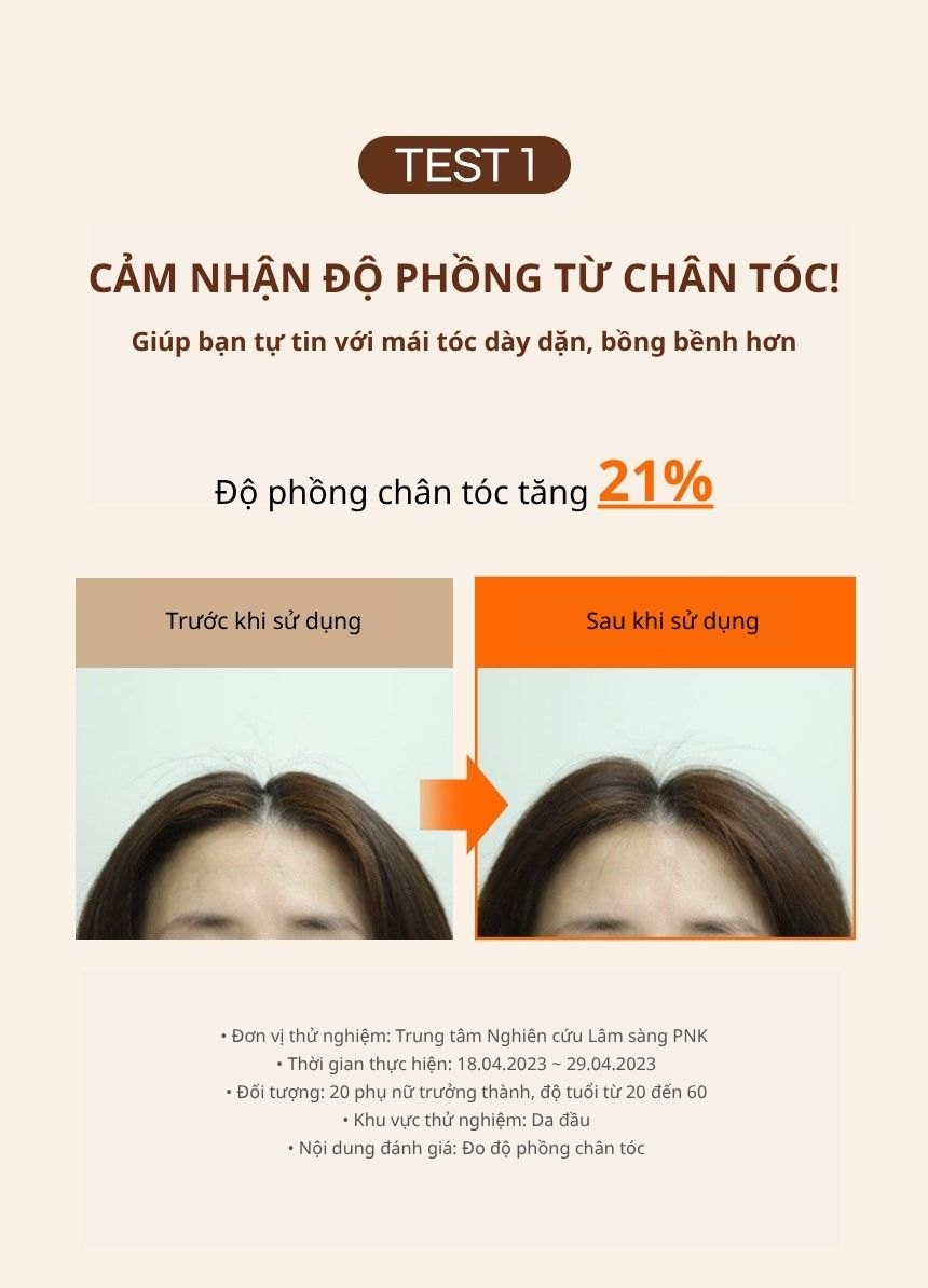 Dầu Xả Ngăn Ngừa Rụng Tóc KUNDAL Real Beer Yeast 200ml