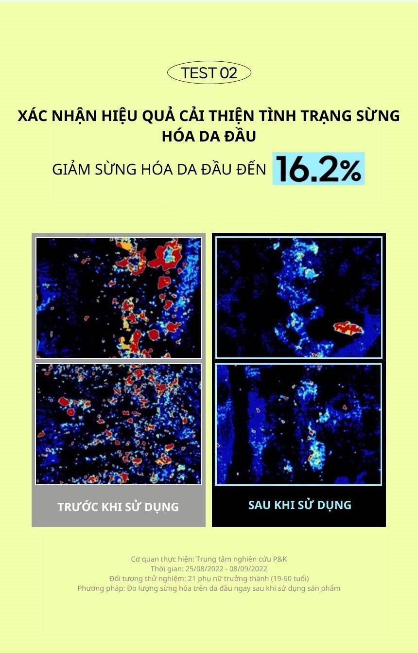 Dầu gội ngăn ngừa mùi da đầu Kundal 400ml