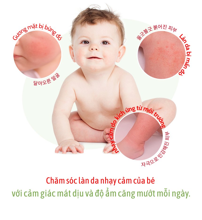 Sữa dưỡng ẩm Soothing Gel làm dịu da cho bé MILK BAOBAB 70ml