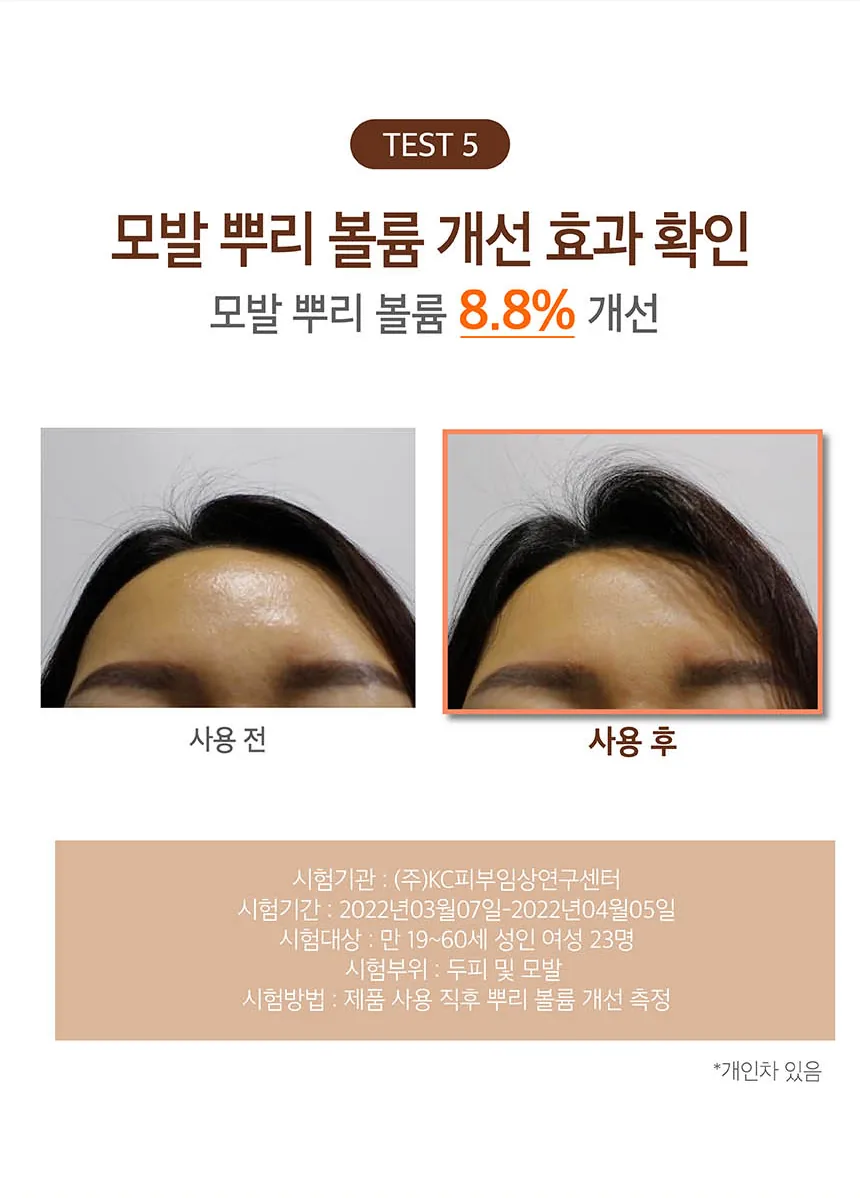 쿤달 맥주효모 탈모케어 샴푸 상세페이지 10