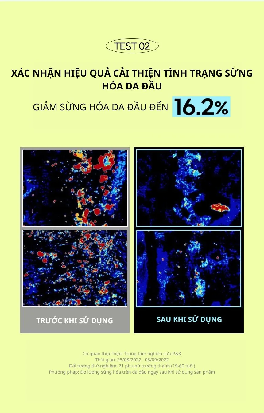 쿤달_스멜커버_청소년샴푸 chi tiết 2