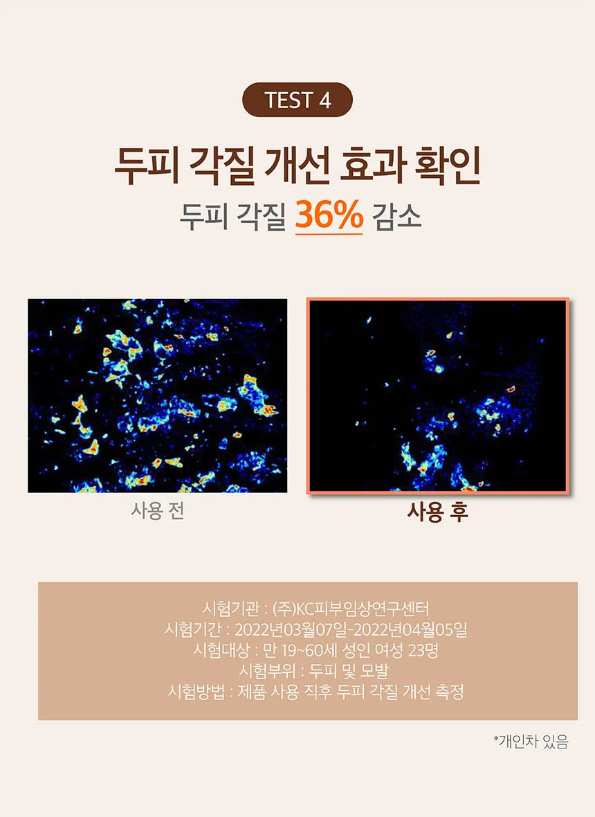 쿤달 맥주효모 탈모케어 샴푸 상세페이지 9