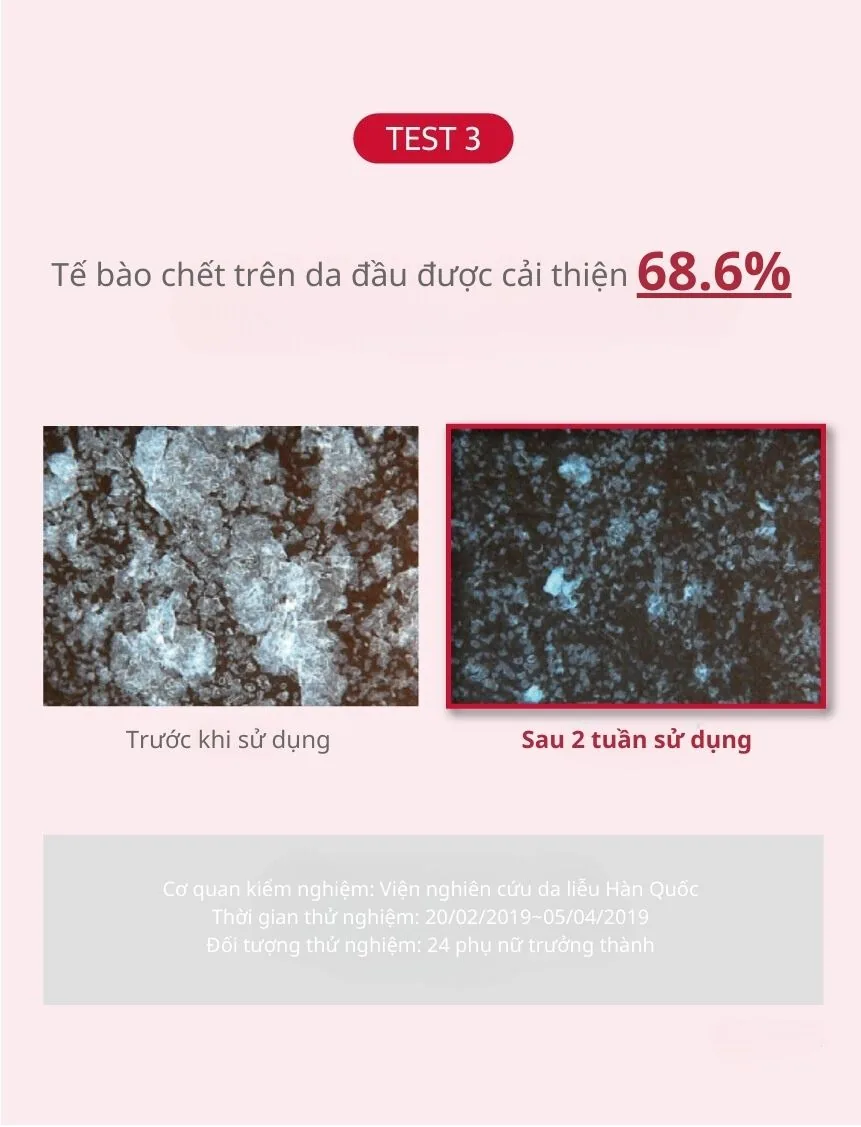 쿤달_카페인_탈모케어샴푸 chi tiết 7